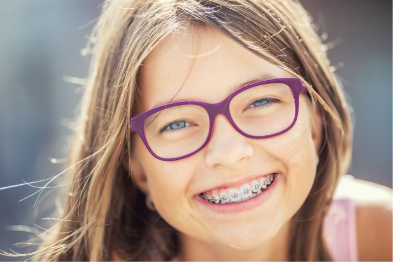 Benefits of Braces in Sandpoint